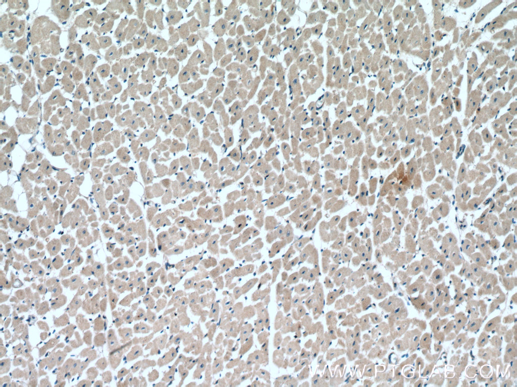 IHC staining of human heart using 17824-1-AP