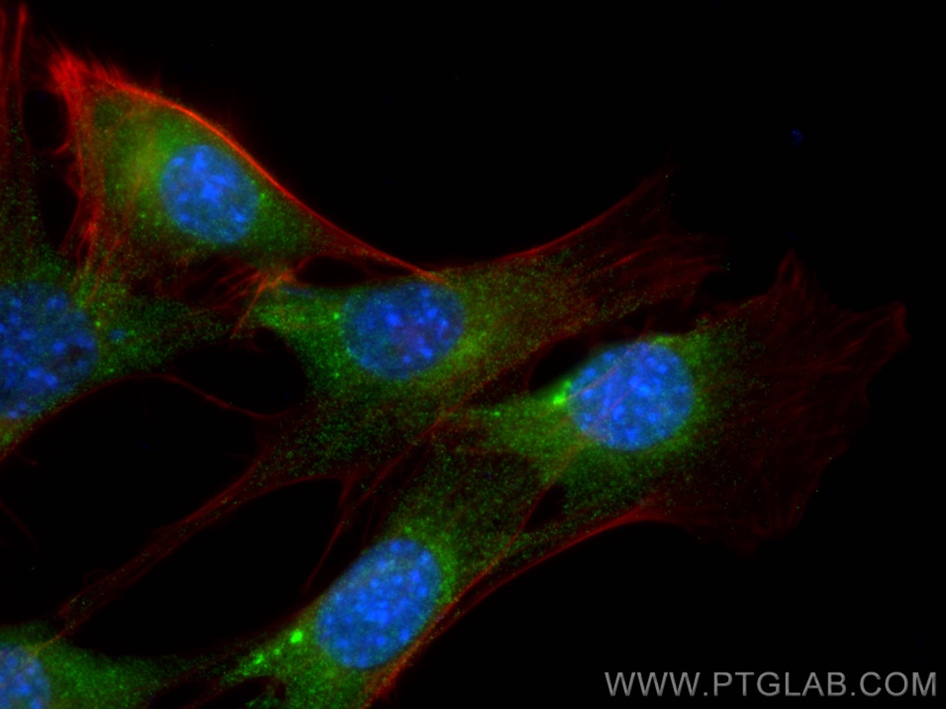 IF Staining of NIH/3T3 using 67837-1-Ig (same clone as 67837-1-PBS)