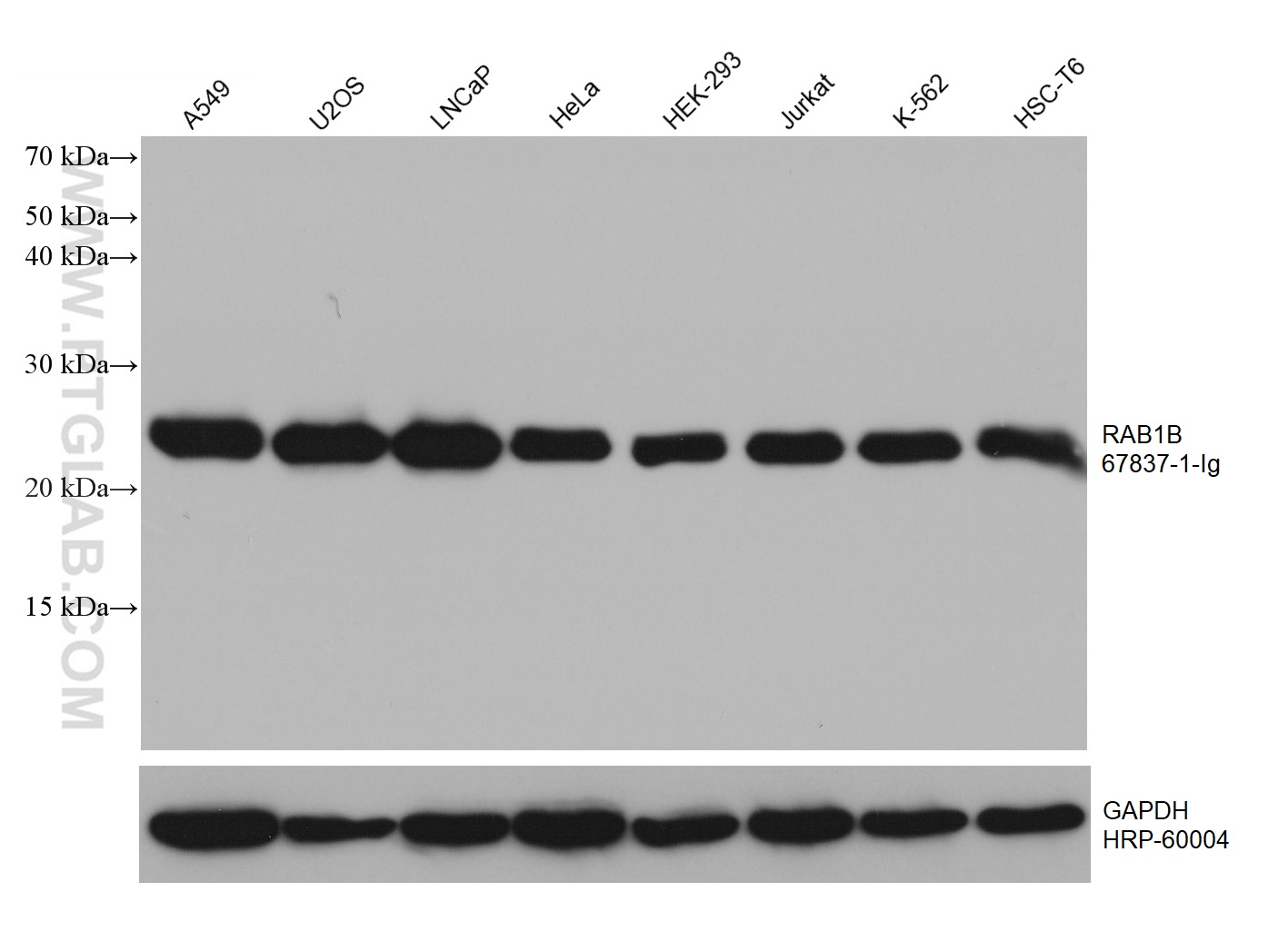 WB analysis using 67837-1-Ig (same clone as 67837-1-PBS)