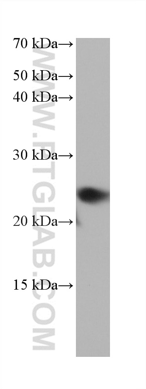 WB analysis of NIH/3T3 using 67837-1-Ig (same clone as 67837-1-PBS)