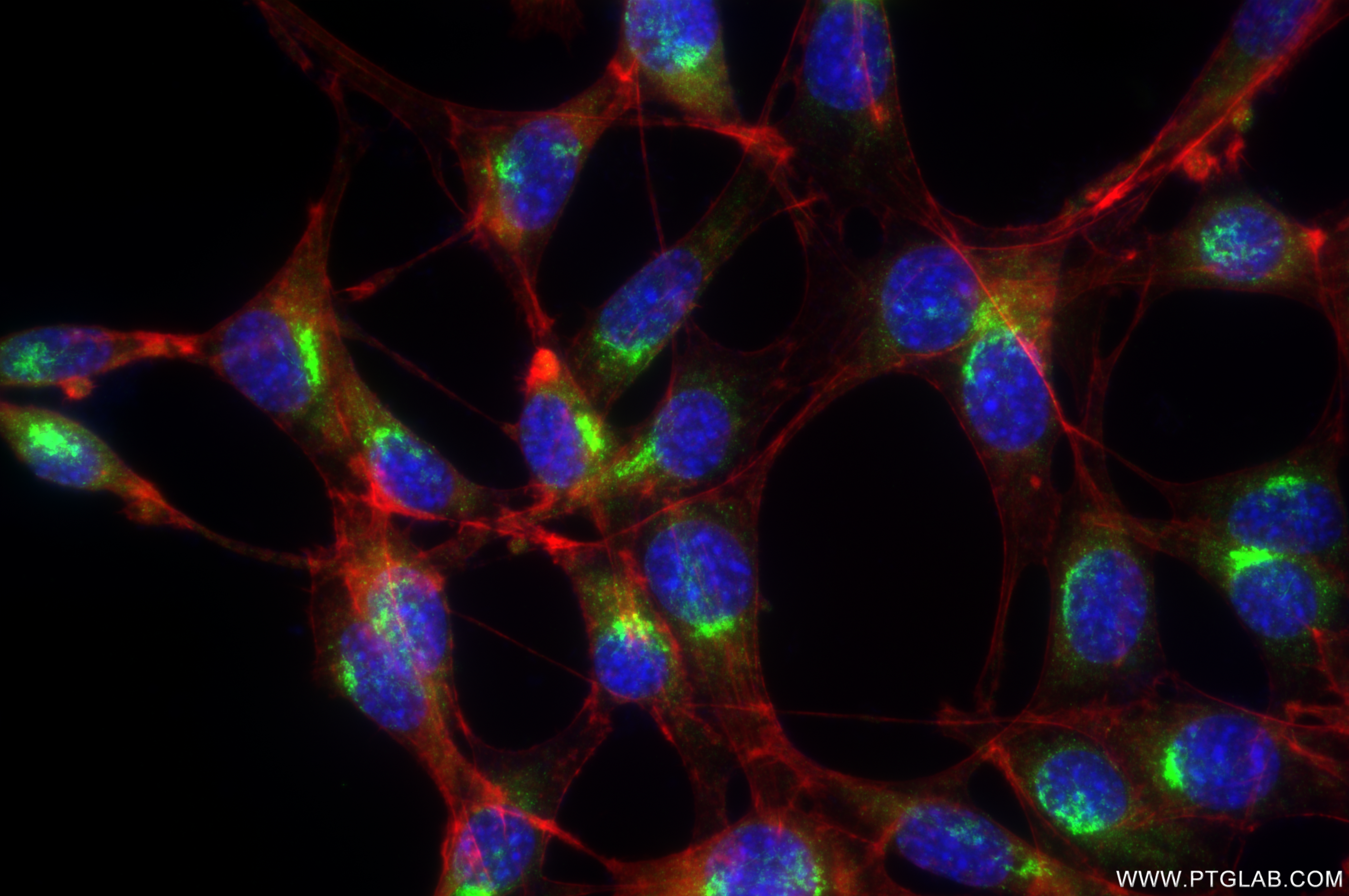 IF Staining of NIH/3T3 using 83687-4-RR (same clone as 83687-4-PBS)
