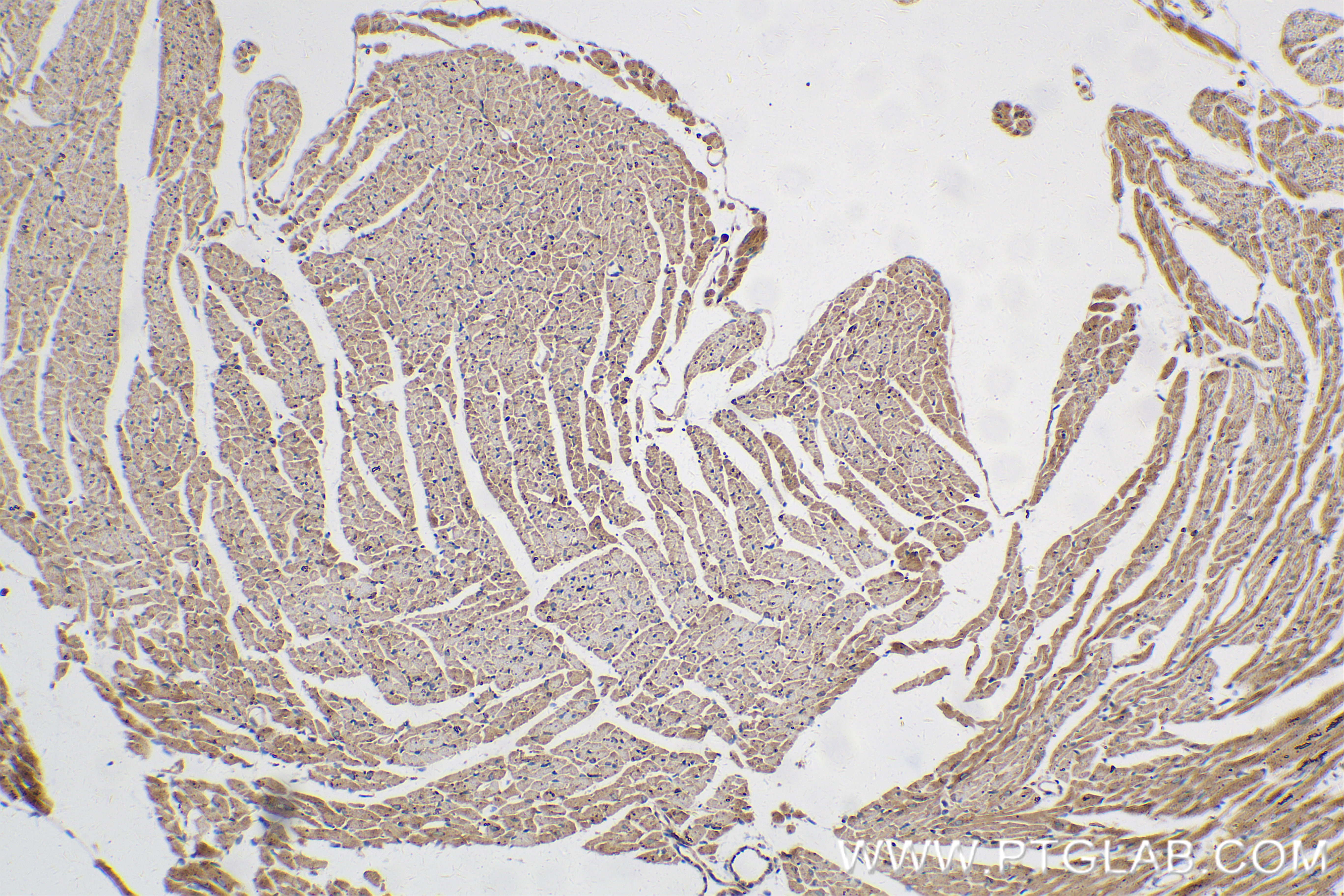 IHC staining of mouse heart using 83687-4-RR (same clone as 83687-4-PBS)