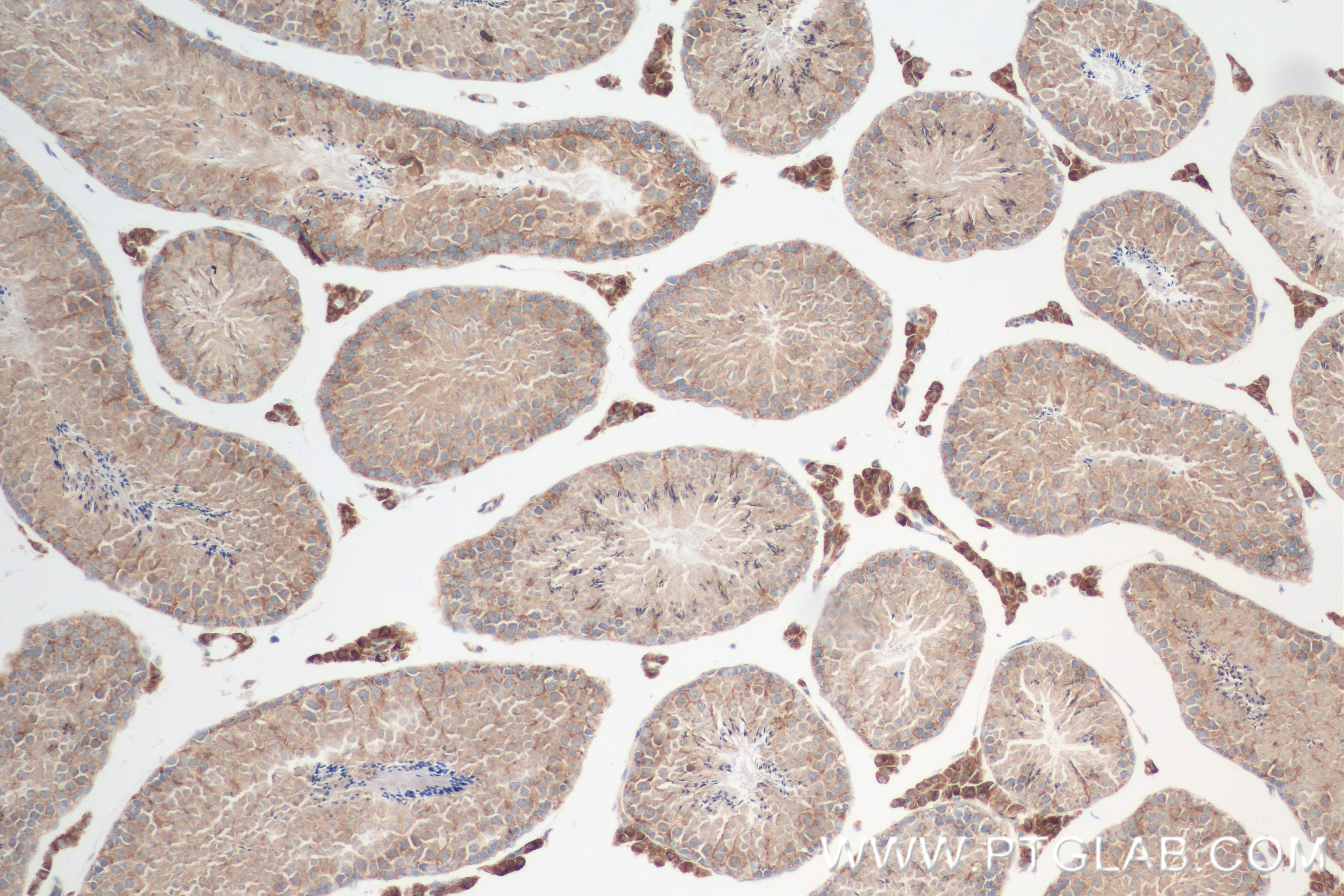 IHC staining of mouse testis using 84776-2-RR (same clone as 84776-2-PBS)