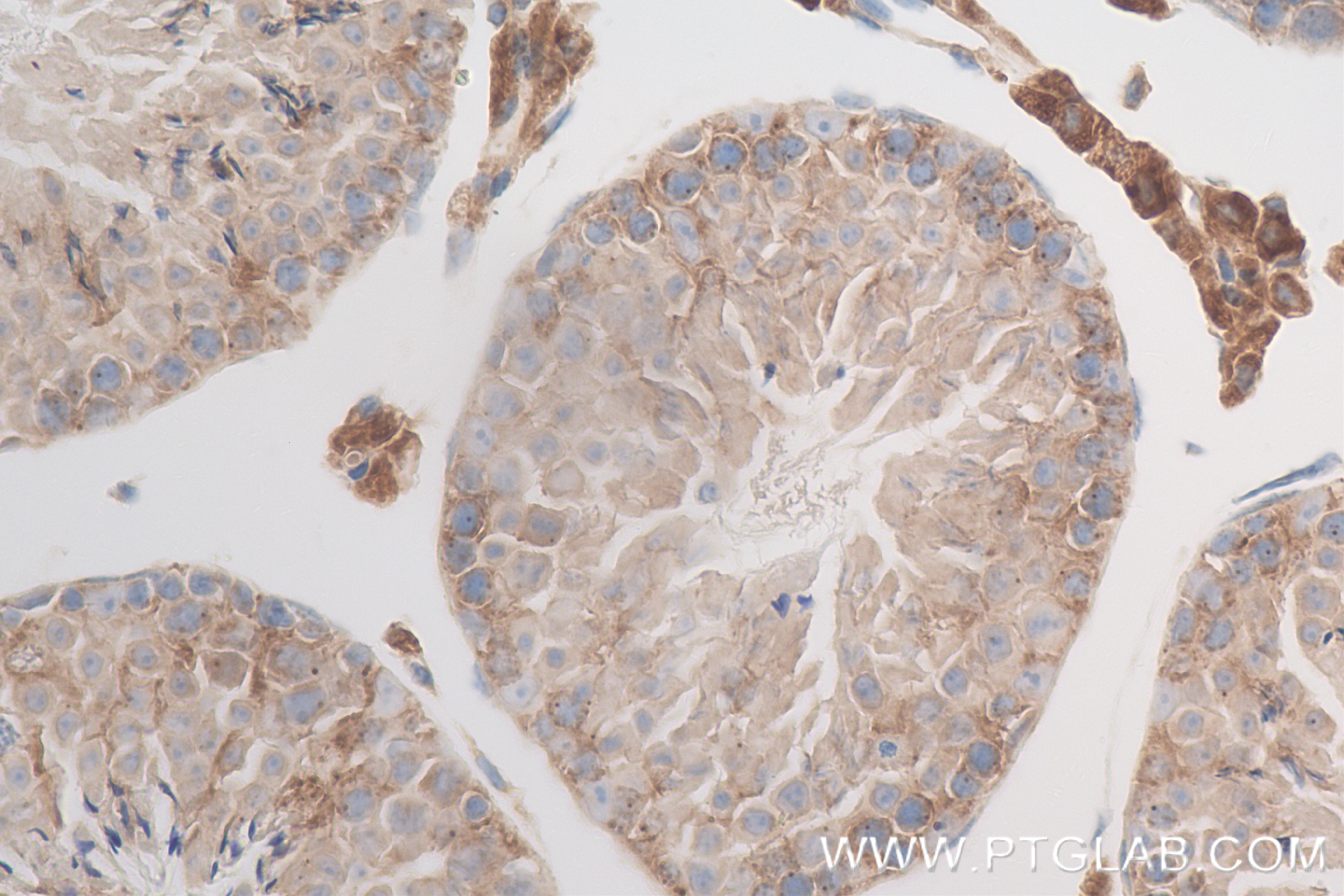 IHC staining of mouse testis using 84776-2-RR (same clone as 84776-2-PBS)