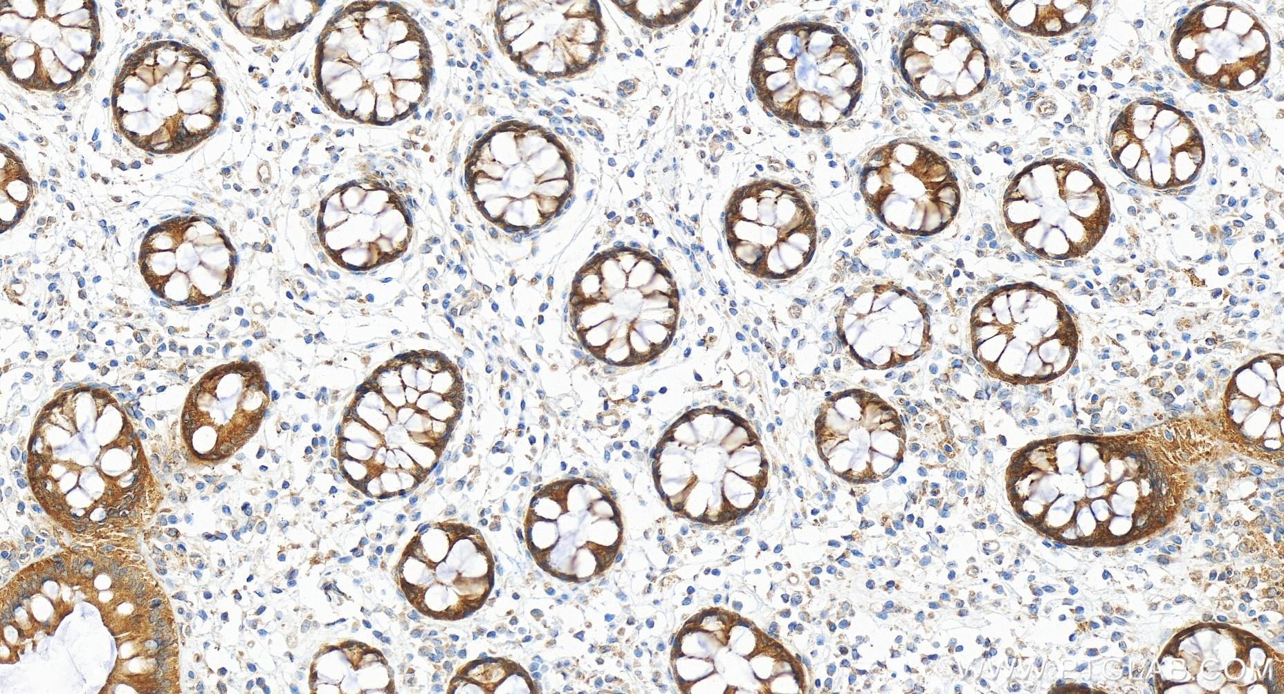 IHC staining of human colon using 84776-2-RR (same clone as 84776-2-PBS)