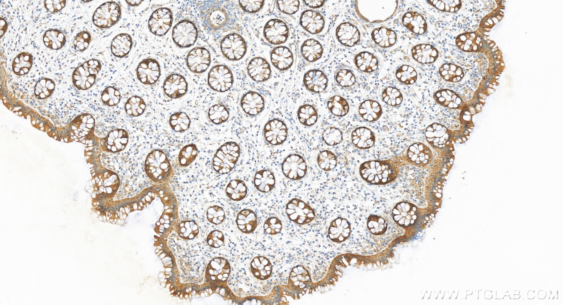 IHC staining of human colon using 84776-2-RR (same clone as 84776-2-PBS)
