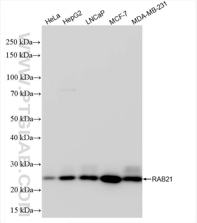 WB analysis using 84776-2-RR (same clone as 84776-2-PBS)