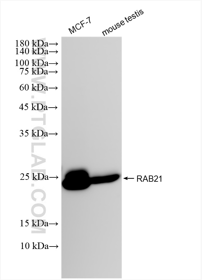 WB analysis using 84776-2-RR WB analysis using 84776-2-RR