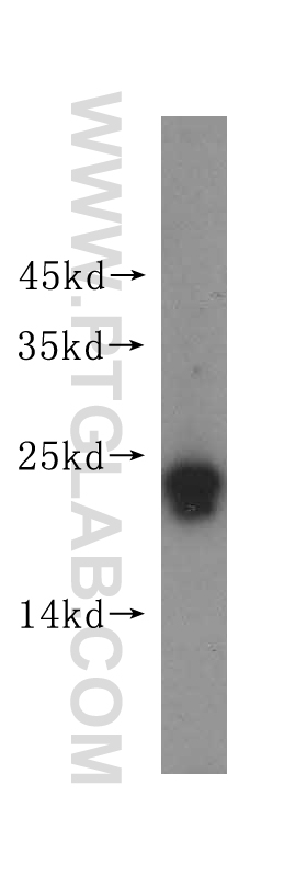 WB analysis of human kidney using 16181-1-AP