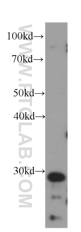 WB analysis of human brain using 60056-1-Ig