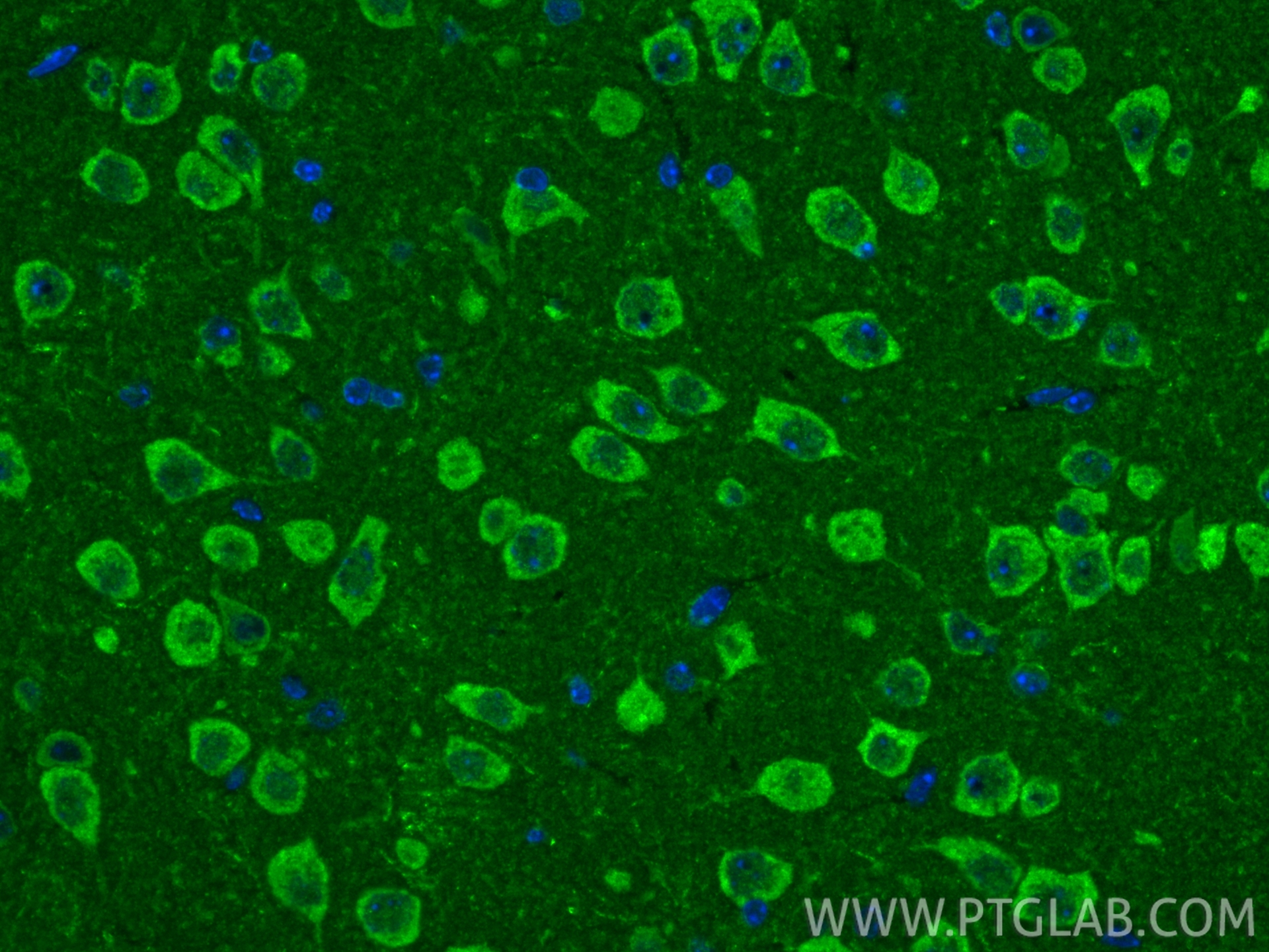 IF Staining of mouse brain using 11445-1-AP IF Staining of mouse brain using 11445-1-AP