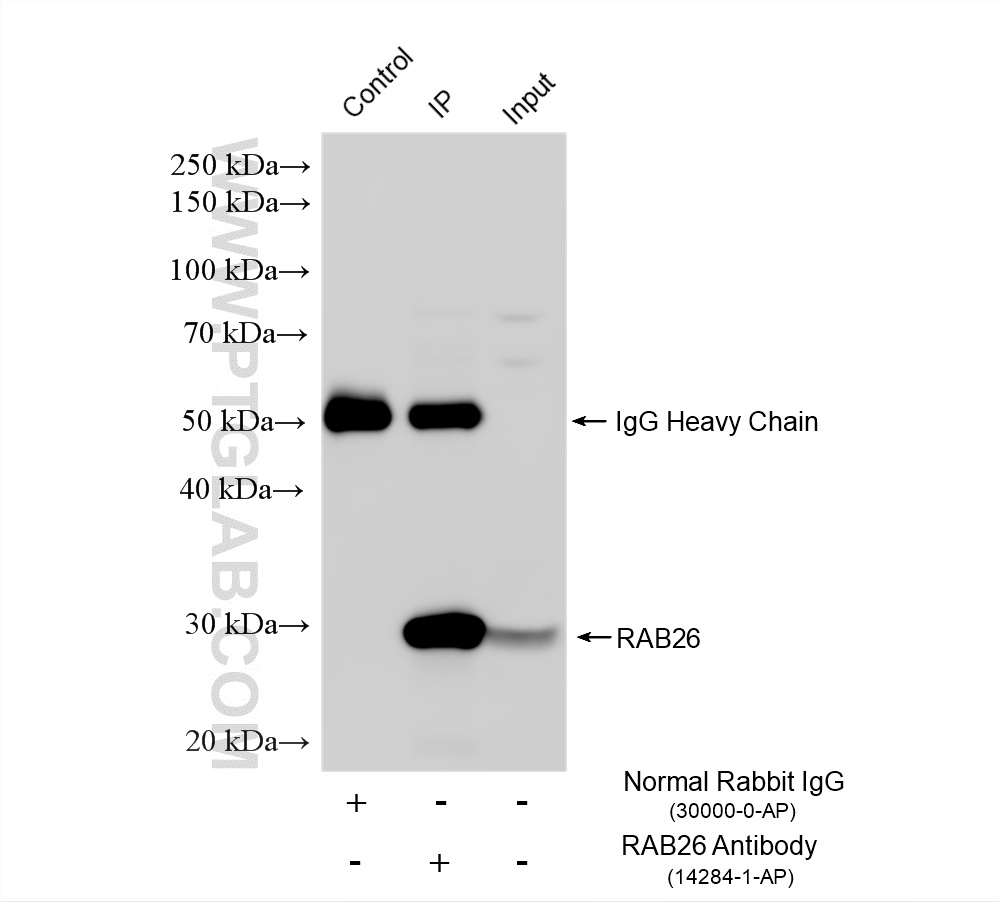 IP experiment of mouse pancreas using 14284-1-AP IP experiment of mouse pancreas using 14284-1-AP