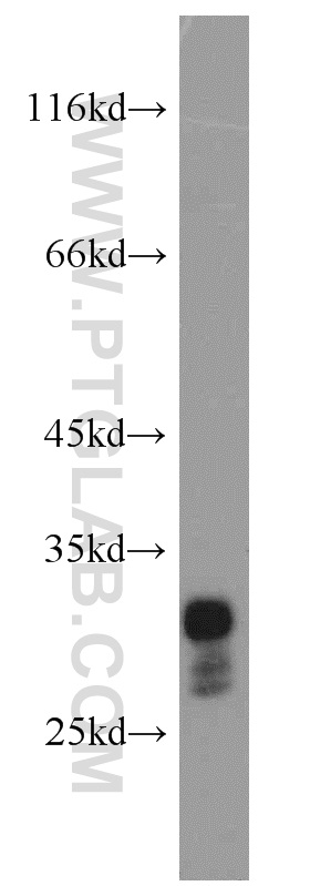 WB analysis of mouse pancreas using 14284-1-AP