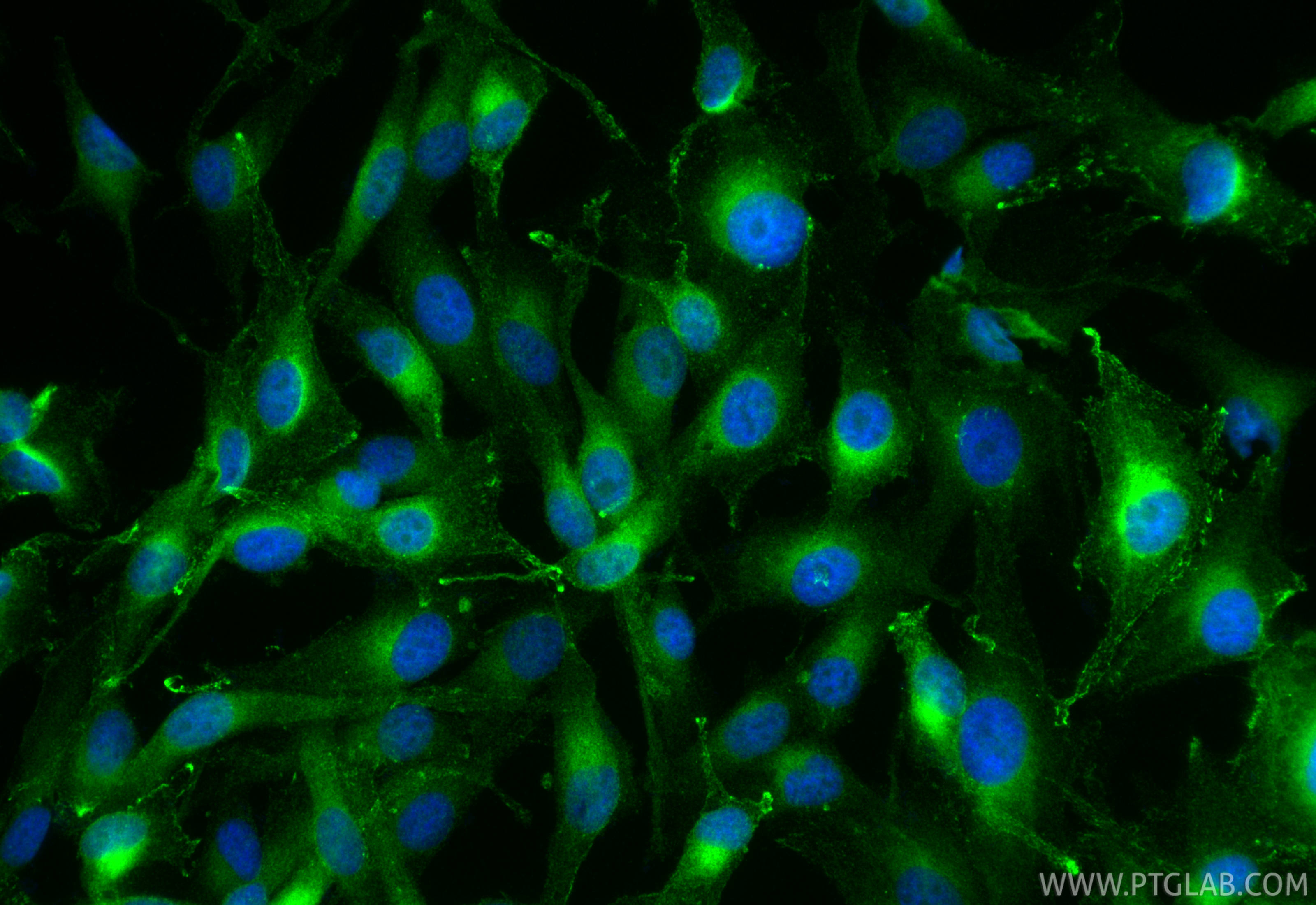 IF Staining of SK-MEL-28 using 17817-1-AP IF Staining of SK-MEL-28 using 17817-1-AP