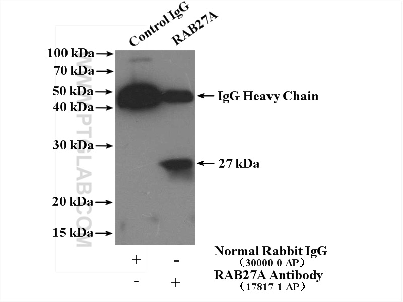 IP experiment of K-562 using 17817-1-AP