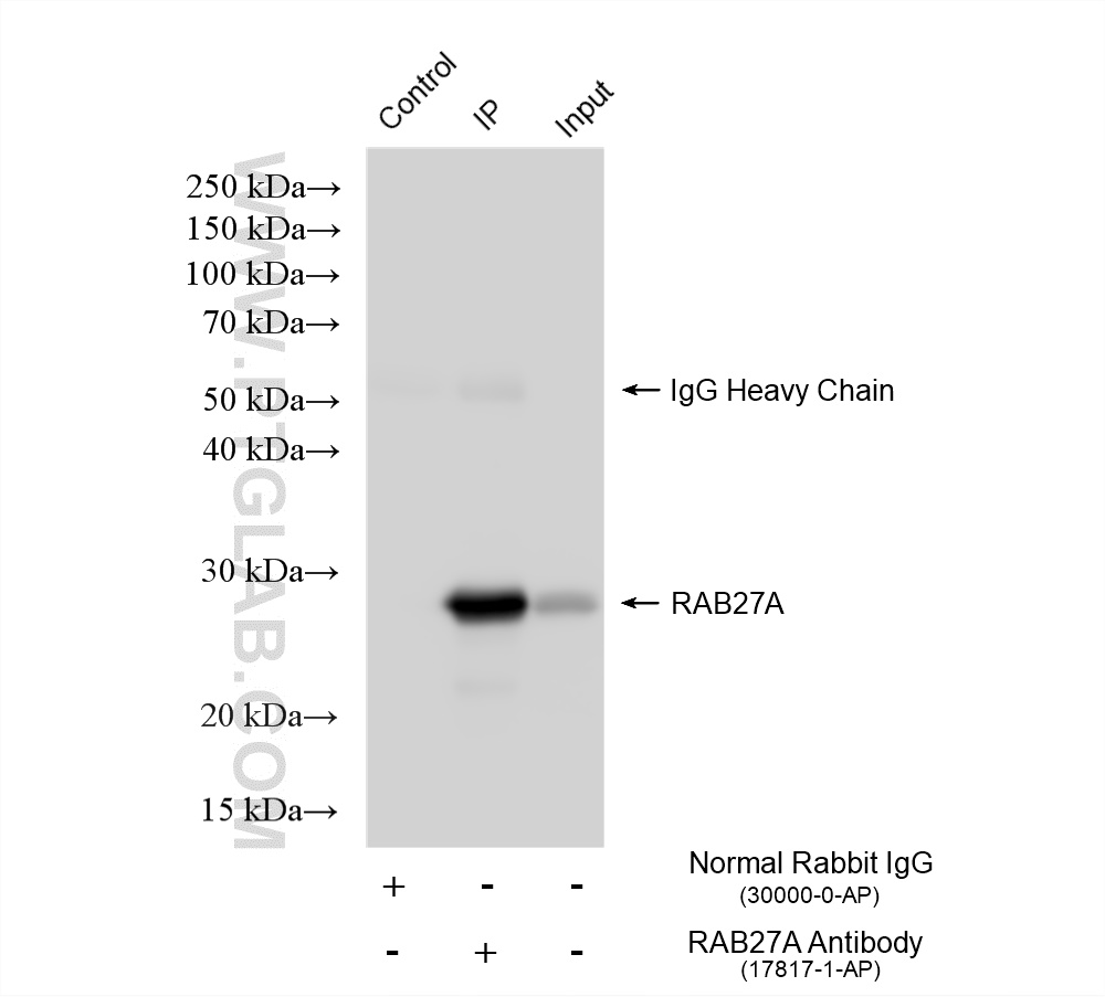 IP experiment of HL-60 using 17817-1-AP