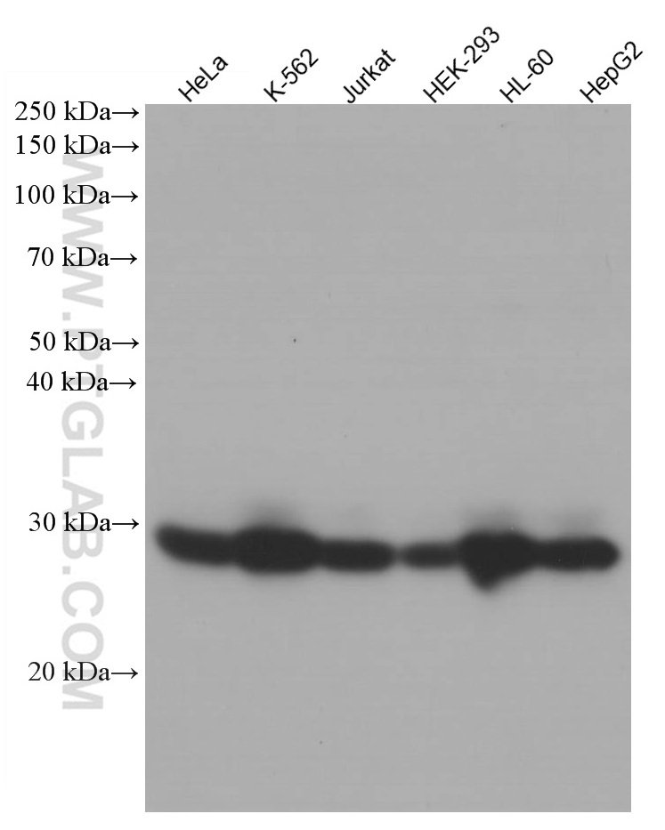 WB analysis using 66058-1-Ig