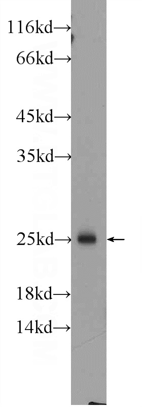 WB analysis of rat spleen using 13412-1-AP