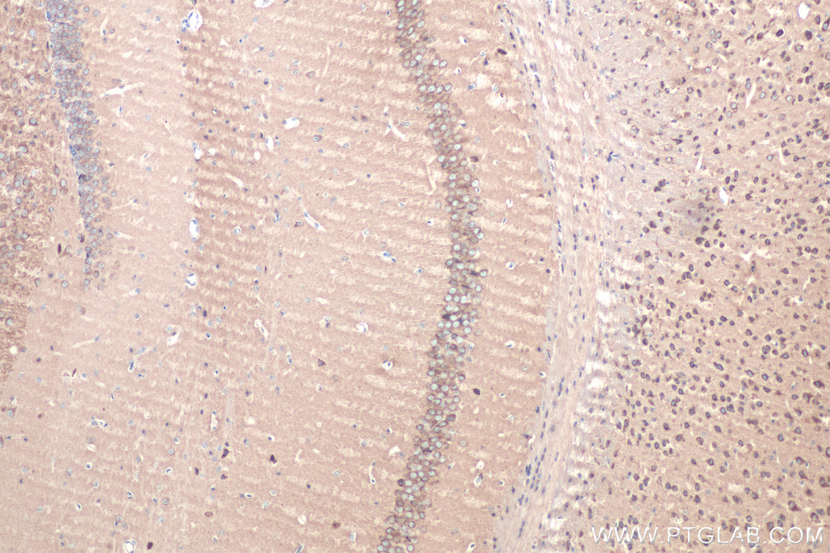 IHC staining of mouse brain using 15420-1-AP IHC staining of mouse brain using 15420-1-AP
