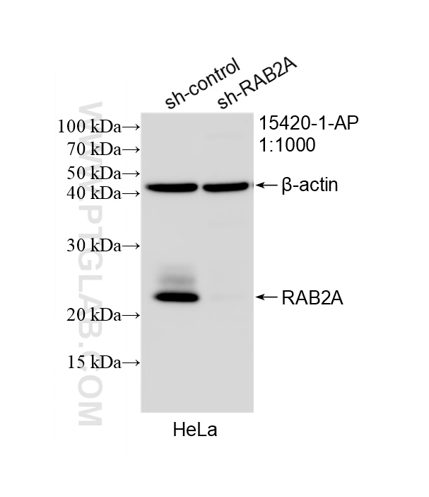 WB result of RAB2 antibody (15420-1-AP; 1:1000; incubated at room temperature for 1.5 hours) with sh-Control and sh-RAB2 transfected HeLa cells. WB analysis of HeLa using 15420-1-AP
