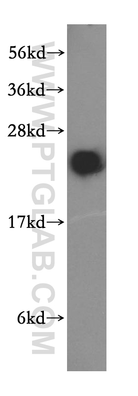 WB analysis of mouse brain using 15420-1-AP