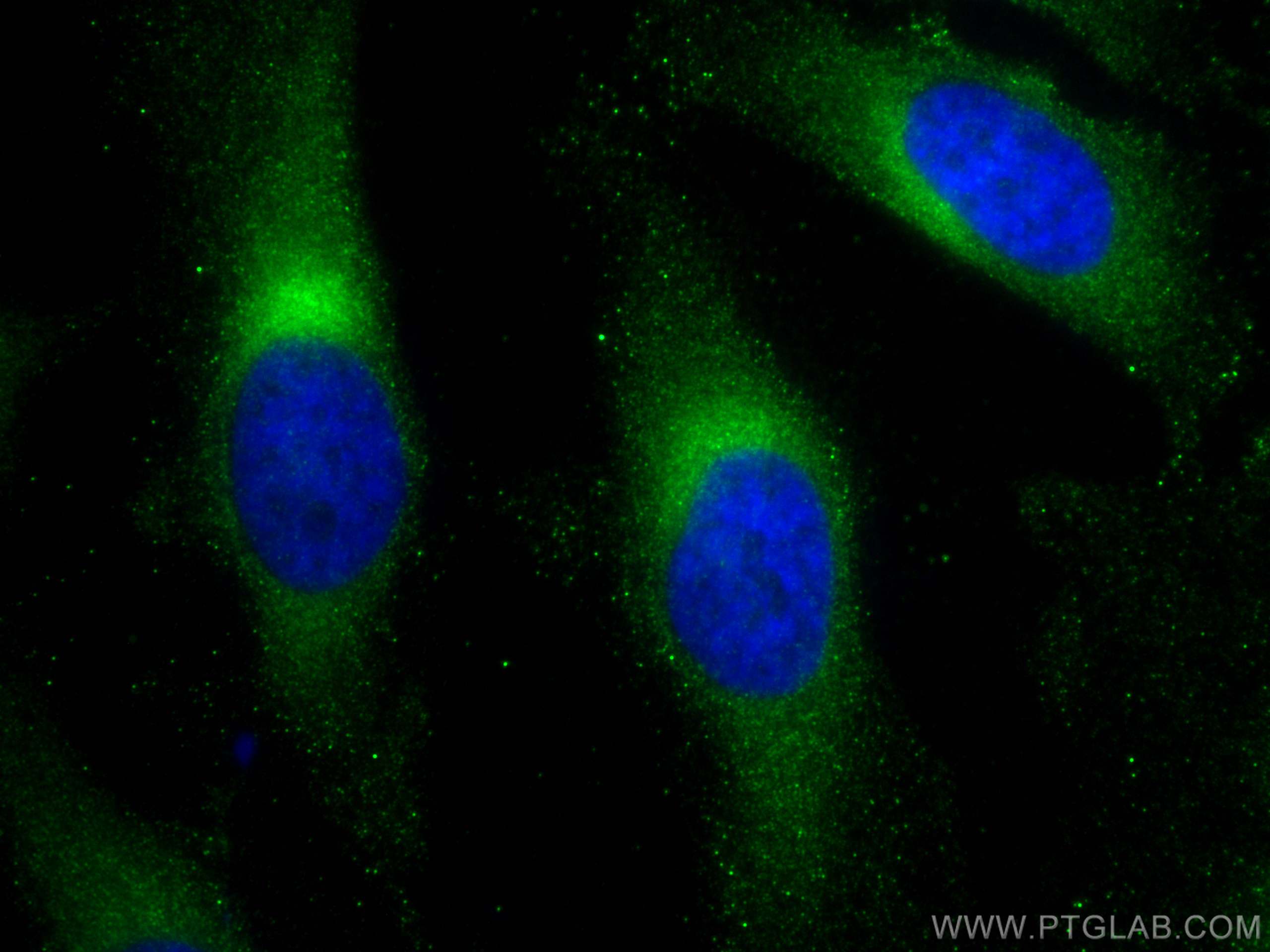 IF Staining of HeLa using 67501-1-Ig (same clone as 67501-1-PBS)