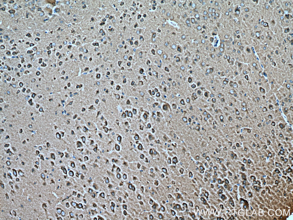 IHC staining of mouse brain using 67501-1-Ig (same clone as 67501-1-PBS)
