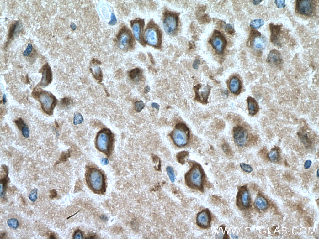 IHC staining of mouse brain using 67501-1-Ig (same clone as 67501-1-PBS)
