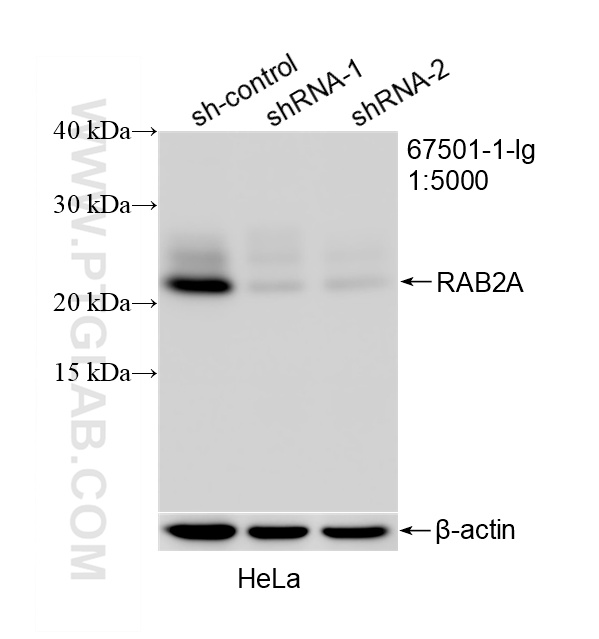WB result of RAB2A antibody (<a class='green' href='/productredirect?CatalogNo=67501-1-Ig' target='_blank'>67501-1-Ig</a>; 1:5000; incubated at room temperature for 1.5 hours) with sh-Control and sh-RAB2A transfected HeLa cells. This data was developed using the same antibody clone with 67501-1-PBS in a different storage buffer formulation. WB analysis of HeLa using 67501-1-Ig (same clone as 67501-1-PBS)
