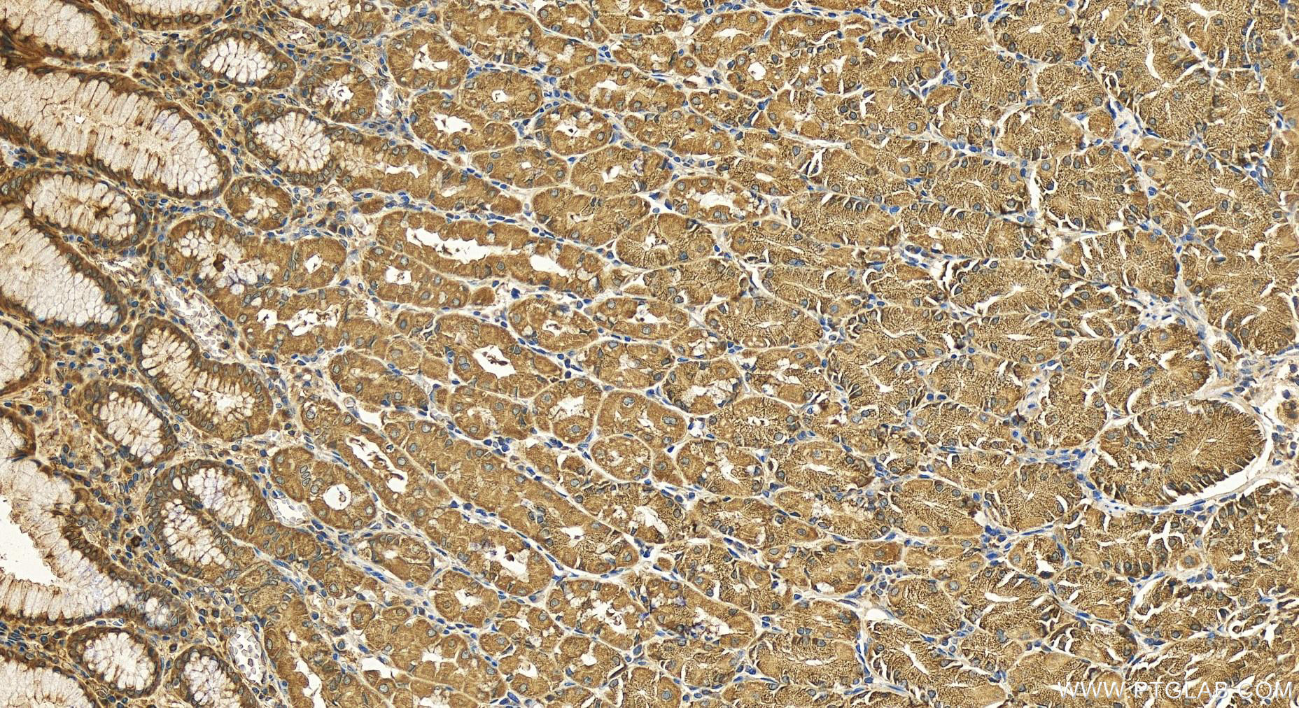 IHC staining of human stomach using 11756-1-AP