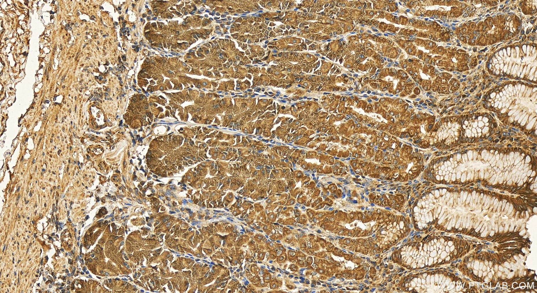 IHC staining of human stomach using 11756-1-AP