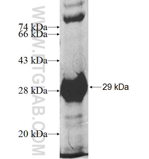 RAB30 fusion protein Ag9682 SDS-PAGE RAB30 fusion protein Ag9682 SDS-PAGE