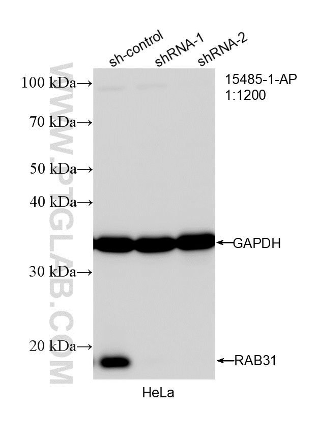 WB result of RAB31 antibody (15485-1-AP; 1:1200; incubated at room temperature for 1.5 hours) with sh-Control and sh-RAB31 transfected HeLa cells. WB analysis of HeLa using 15485-1-AP