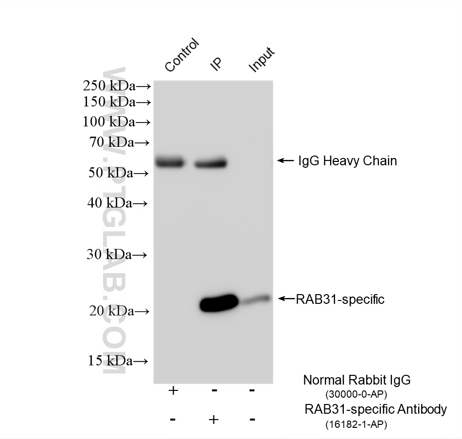 IP experiment of U-87 MG using 16182-1-AP