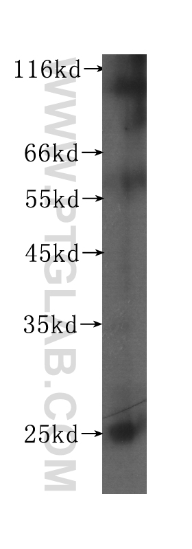 WB analysis of mouse colon using 60146-1-Ig