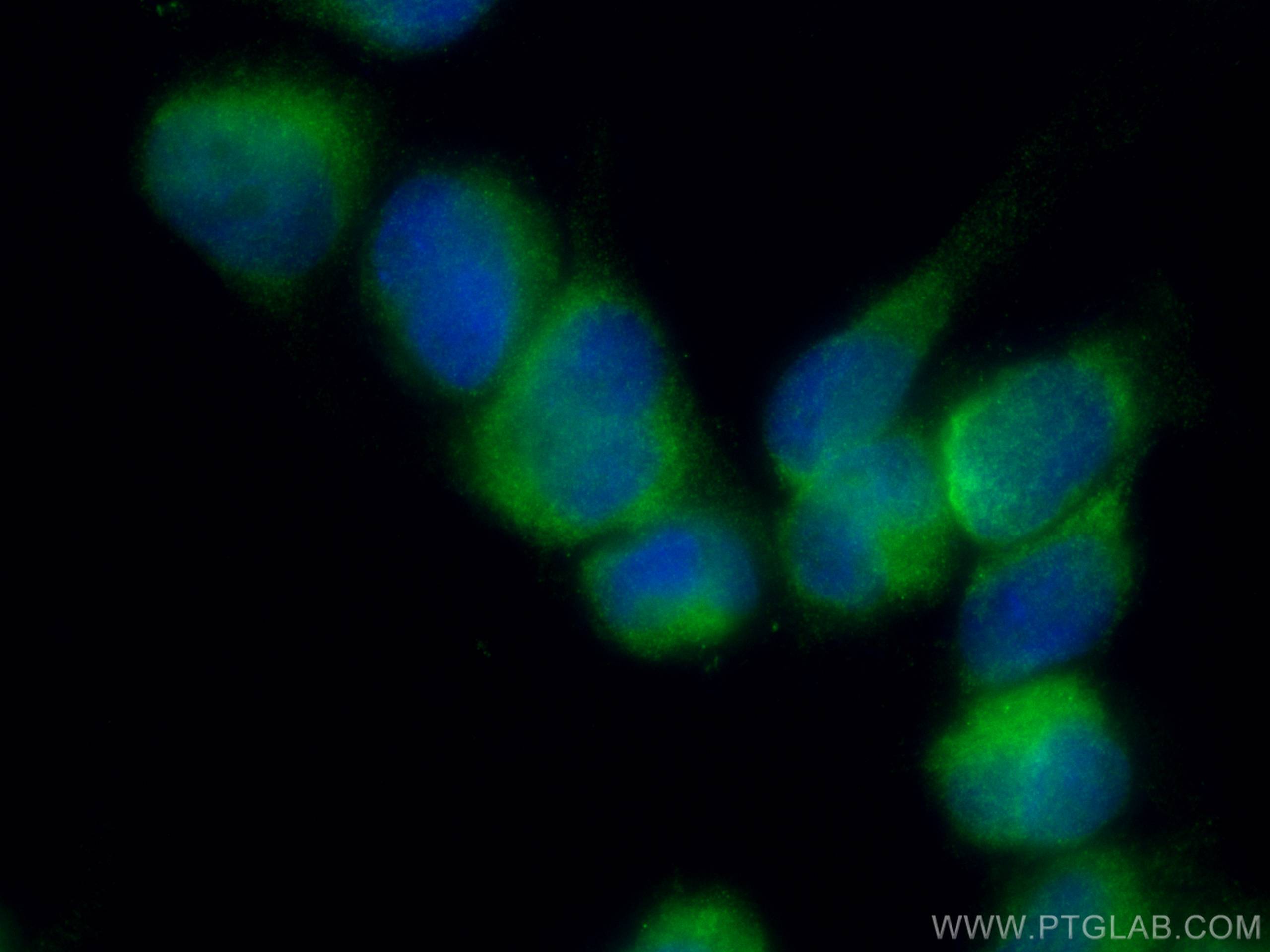 IF Staining of U-251 using 10999-1-AP