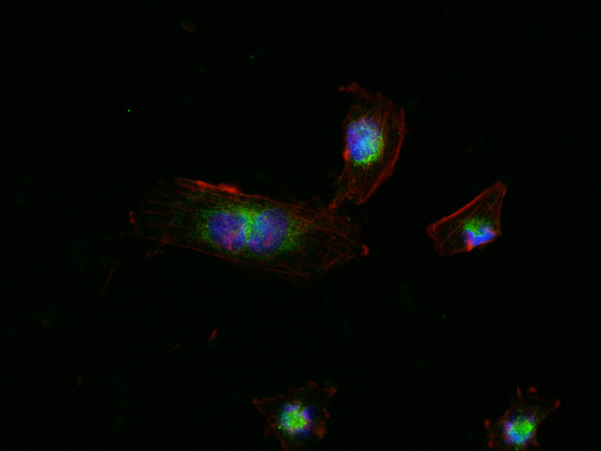 IF Staining of U-251 using 82960-5-RR (same clone as 82960-5-PBS)