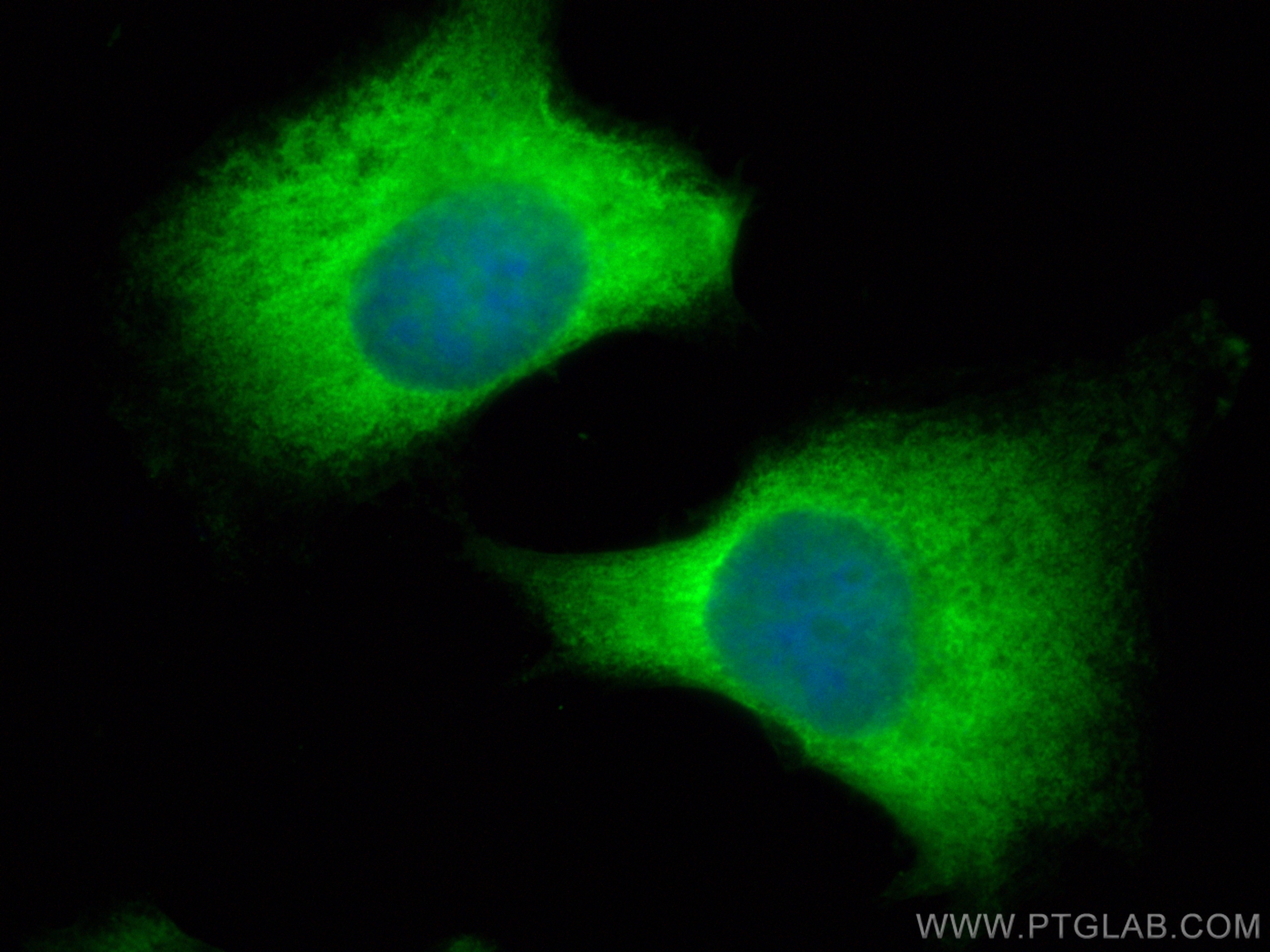 IF Staining of HeLa using CL488-82960-5