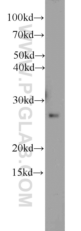 WB analysis of mouse brain using 11025-1-AP