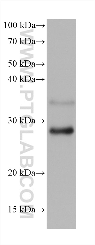 RAB33A