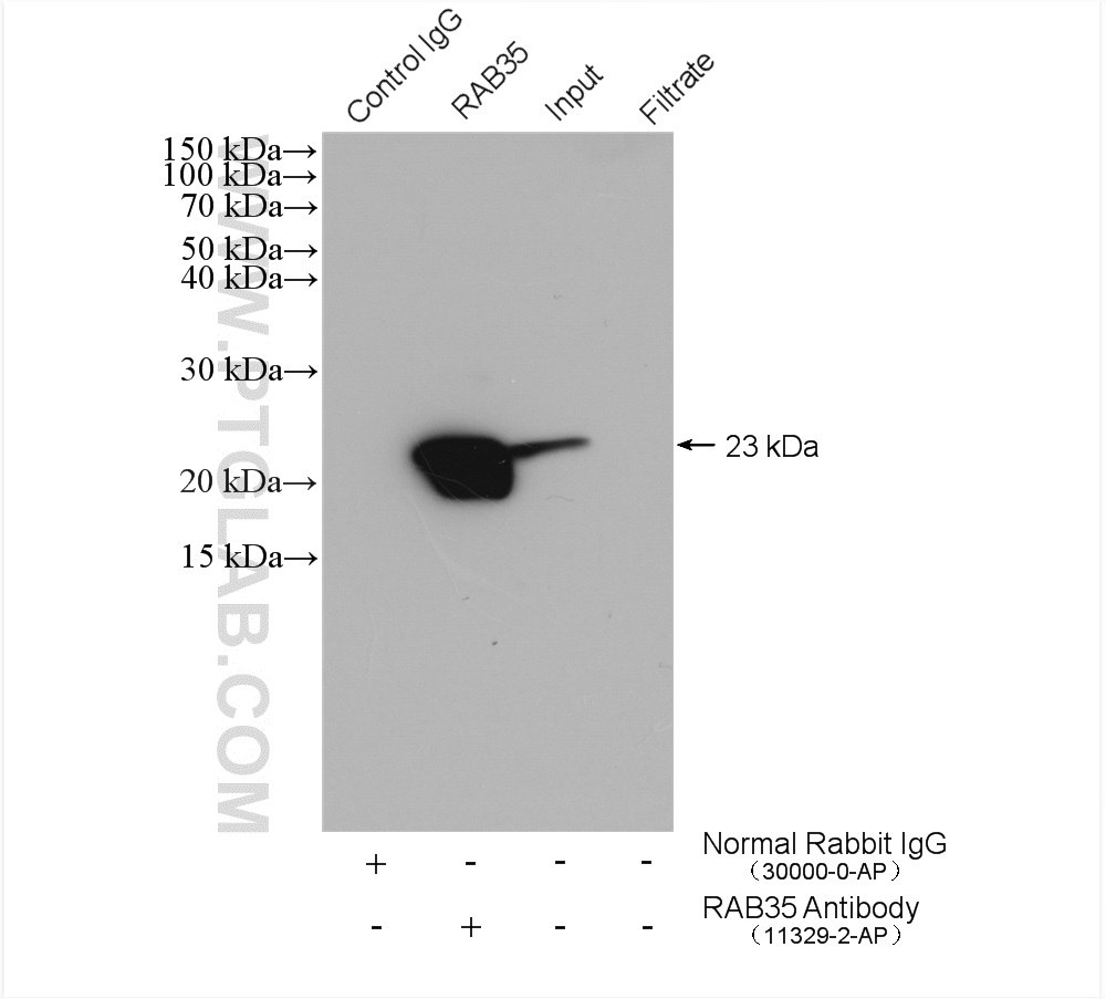 IP experiment of mouse brain using 11329-2-AP