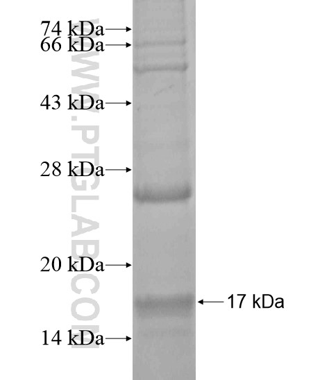 RAB36 fusion protein Ag20007 SDS-PAGE RAB36 fusion protein Ag20007 SDS-PAGE