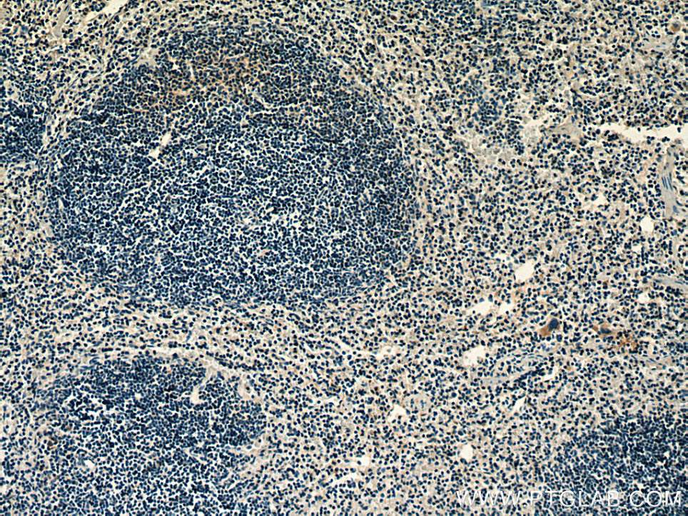 IHC staining of mouse spleen using 13051-1-AP