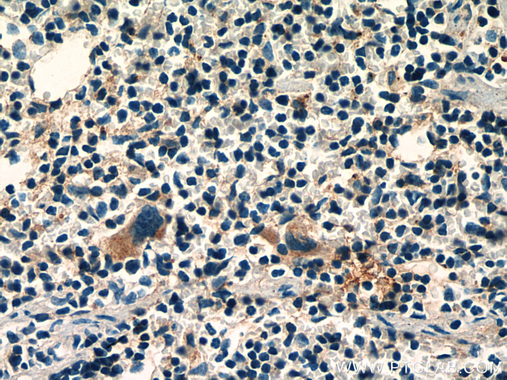 IHC staining of mouse spleen using 13051-1-AP