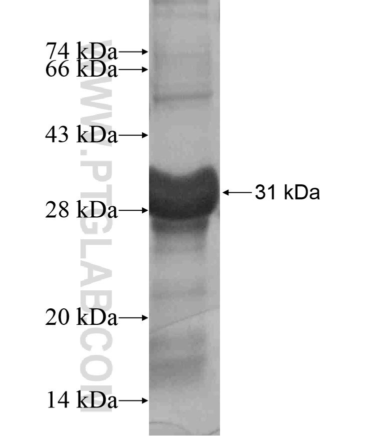 RAB39 fusion protein Ag17876 SDS-PAGE RAB39 fusion protein Ag17876 SDS-PAGE
