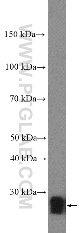 WB analysis of fetal human brain using 12162-1-AP