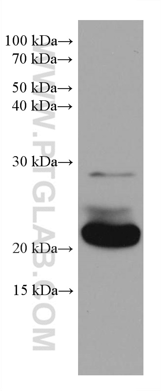 WB analysis of rabbit brain using 68014-1-Ig (same clone as 68014-1-PBS)