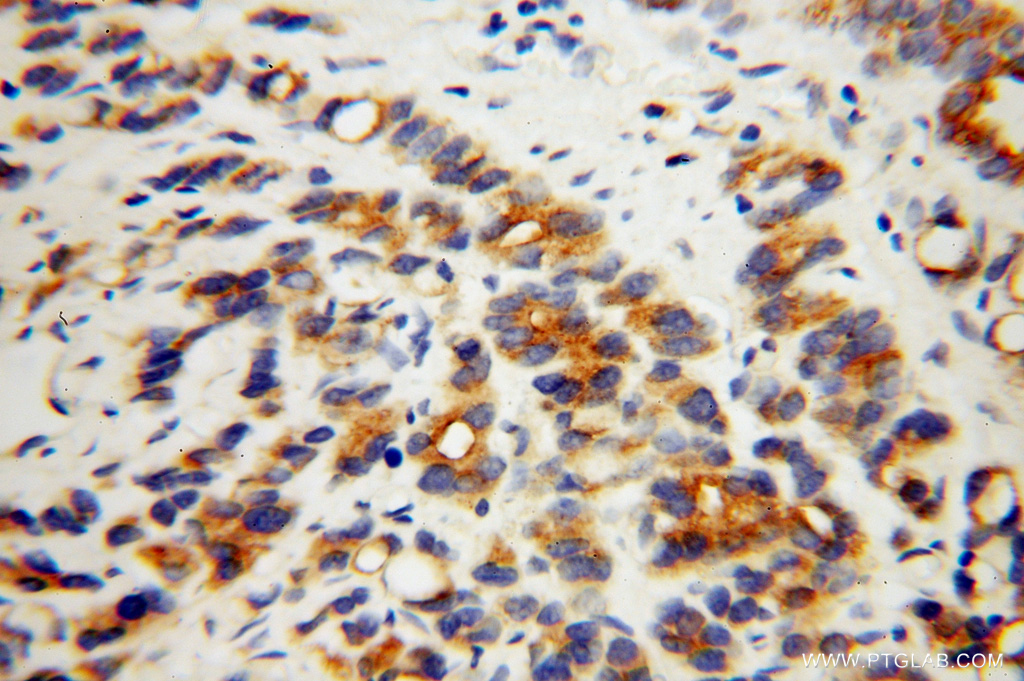 RAB3A Polyclonal antibody