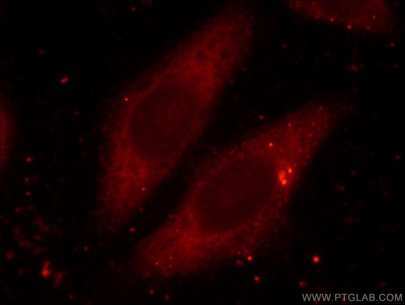 IF Staining of HeLa using 16865-1-AP