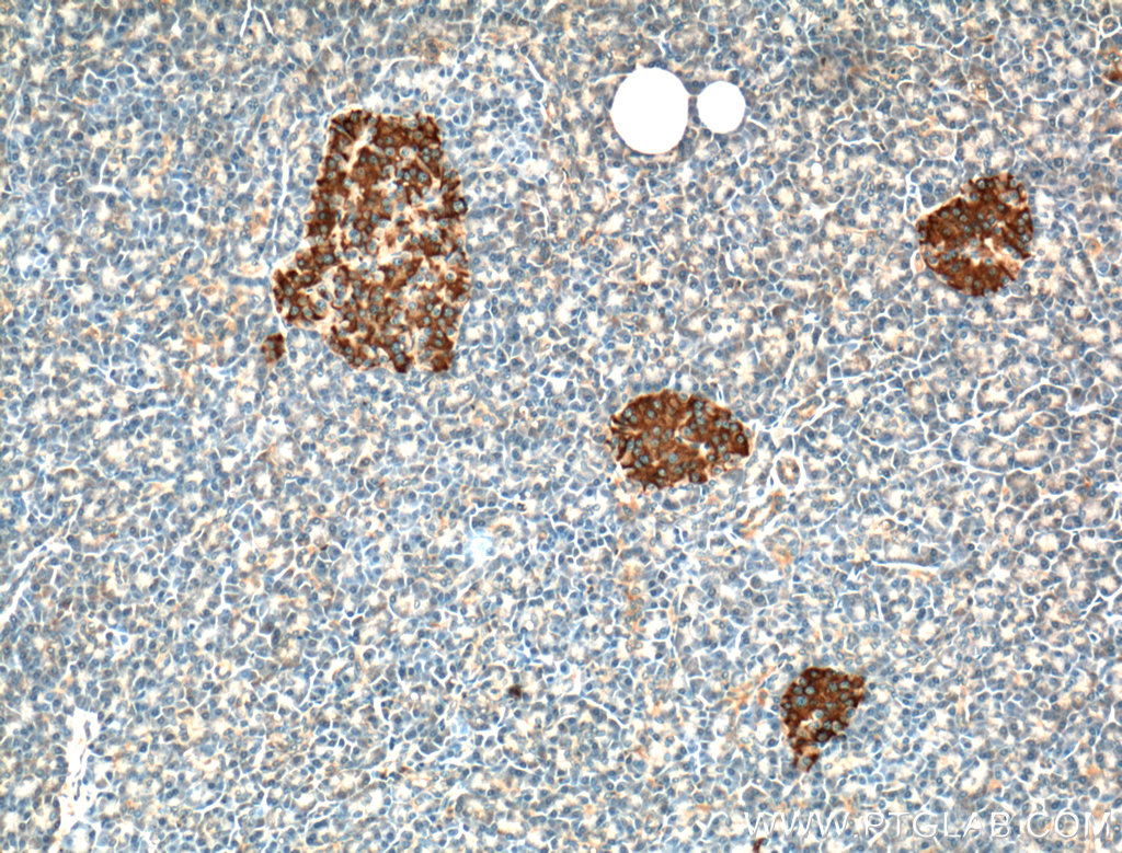 IHC staining of human pancreas using 16865-1-AP